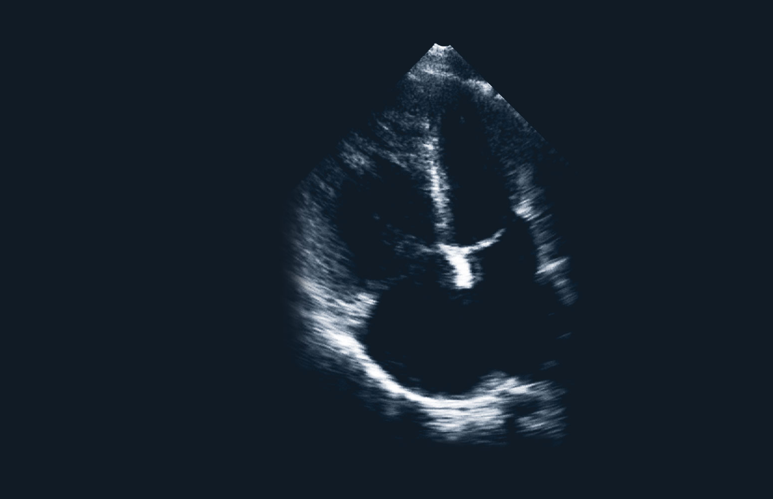 Echo Masterclass: Adult Congenital Heart Disease course