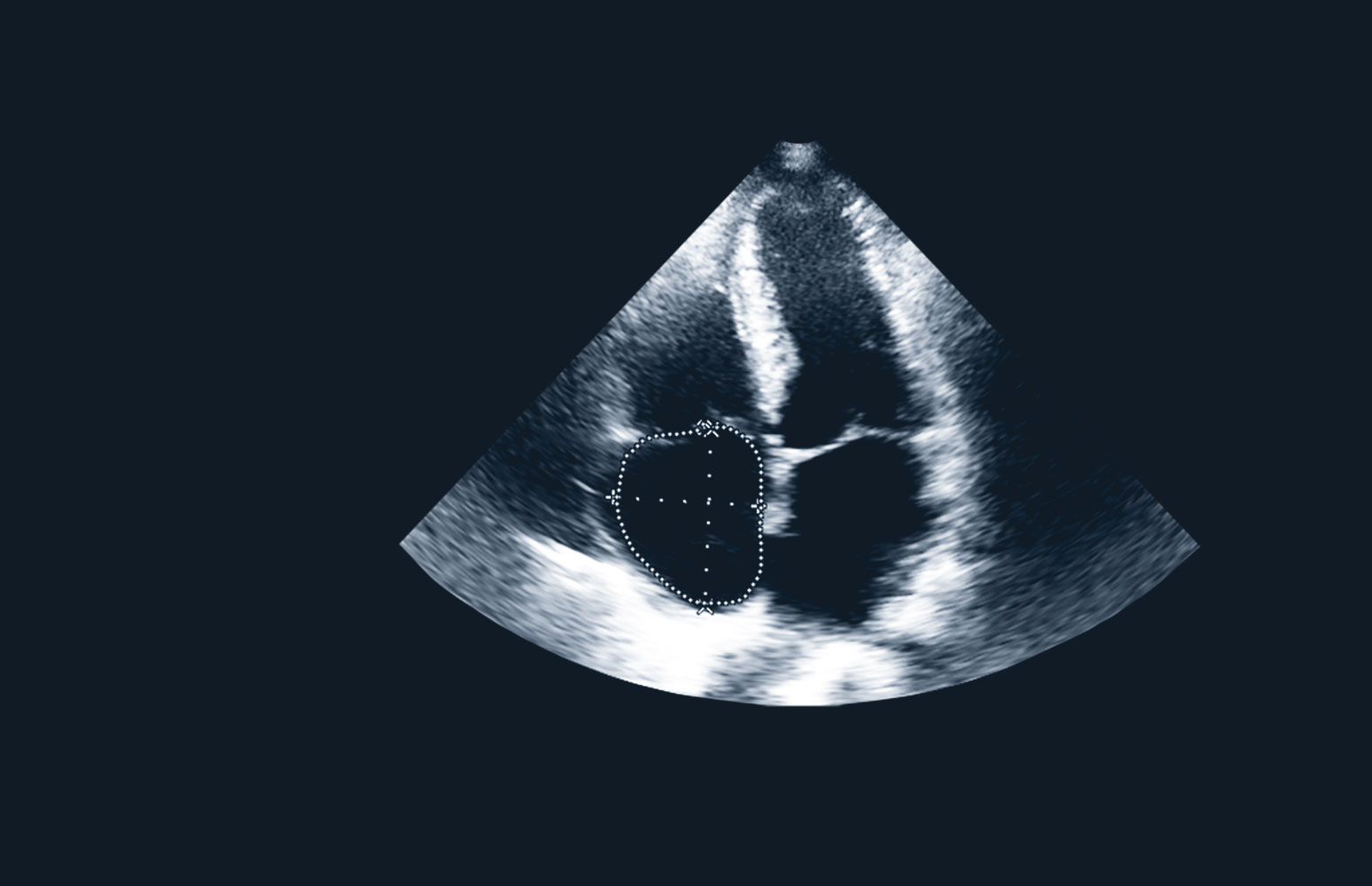 Echo Masterclass: The Valves course