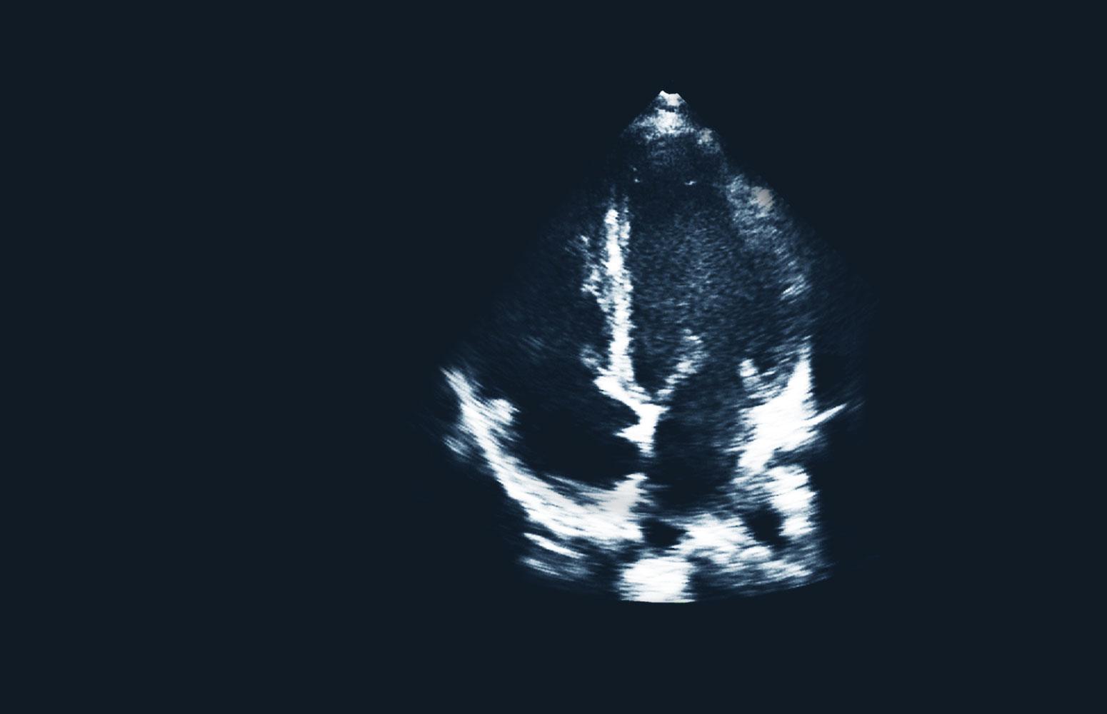Echocardiography Essentials course